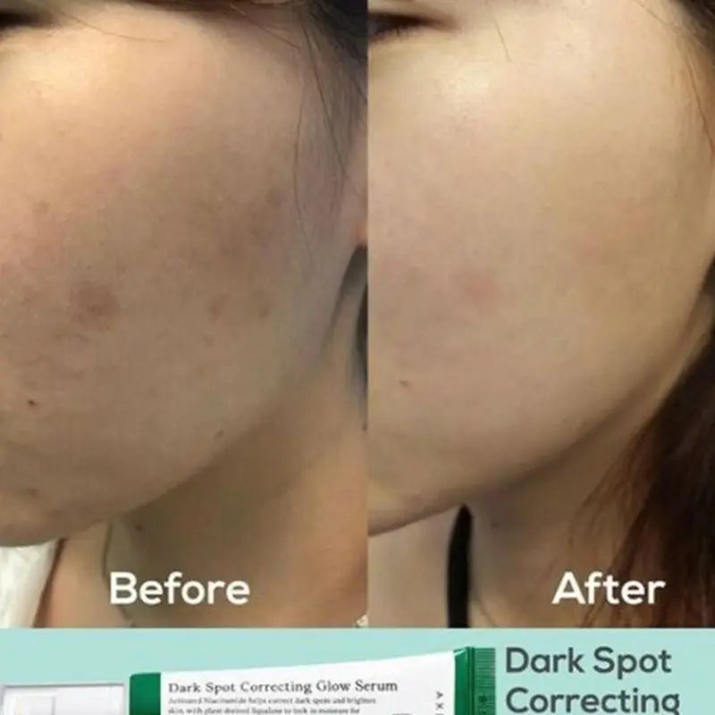 Axis-Y Dark Spot Correcting Brighten + Moisturize Glow Facial Serum 50ml Axis-Y