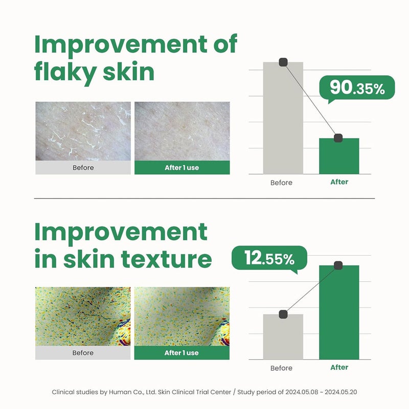 Axis-Y 10% PHA Resurfacing Skin Glow Peel 50ml