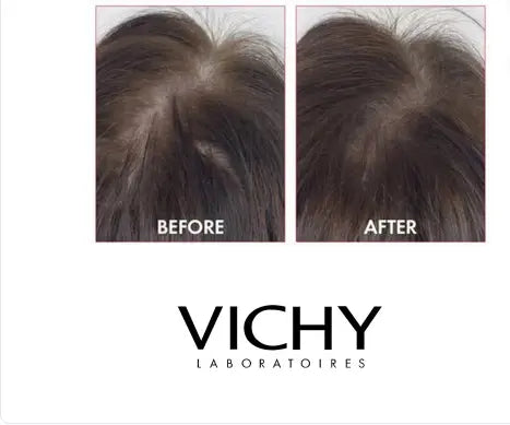 Vichy Dercos Aminexil Clinical 5 Anti-Hair Fall Treatment For Men, Pack of 6ml x 21's Vichy