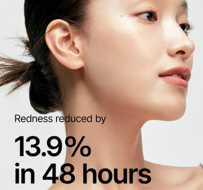 Anua Heartleaf 77% Soothing Facial Toner For Redness & Acne- Prone Skin Type 250ml Anua