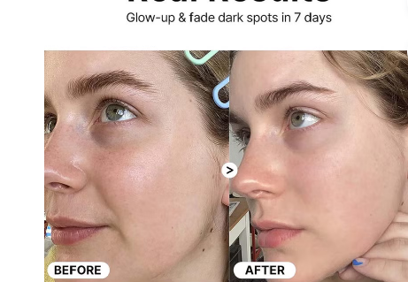 Cosrx The Vitamin C 23 Anti-Aging Serum With Super Vitamin E + Hyaluronic Acid 20ml