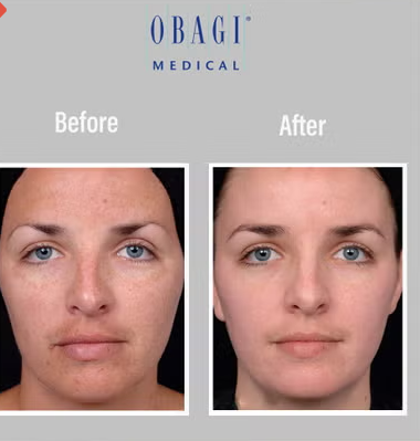 Obagi - C Fx C -Clarifying Skin Brightening Facial Serum With Vitamin C 30ml