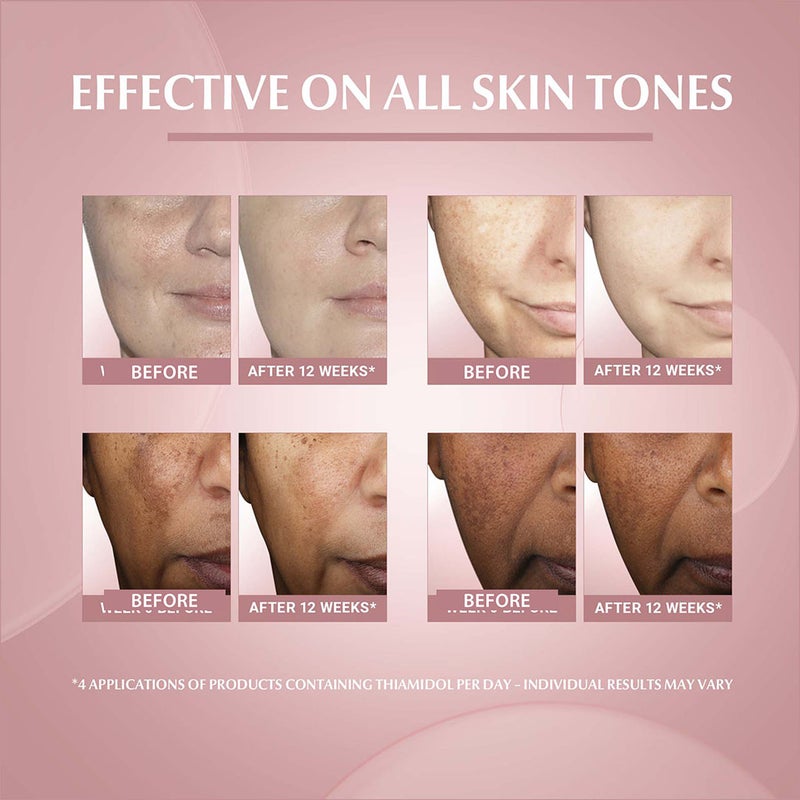 Eucerin Even Pigment Perfector Anti-Pigment Skin Perfecting Serum 30ml Eucerin