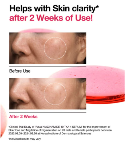 Niacinamide 10% + Txa 4% Serum 30Ml Packaging May Vary 30 mlml Anua