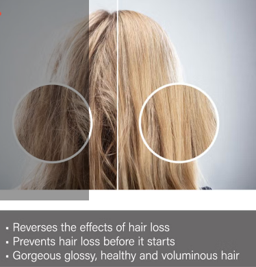 Regrow Step 1 -Cleanse & Prepare Shampoo For Women 300ml