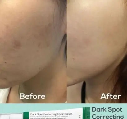 Axis-Y Dark Spot Correcting Brighten + Moisturize Glow Facial Serum 50ml Axis-Y