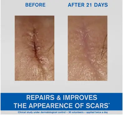 Uriage Bariederm-Cica Cream 100ml Uriage