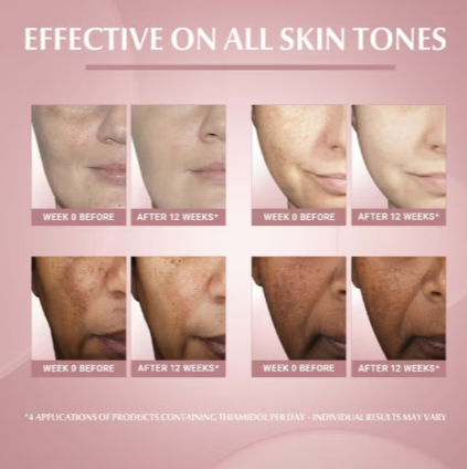 Even Pigment Perfector Face Day Cream With Thiamidol Moisturizer For All Skin Types 50ml Eucerin