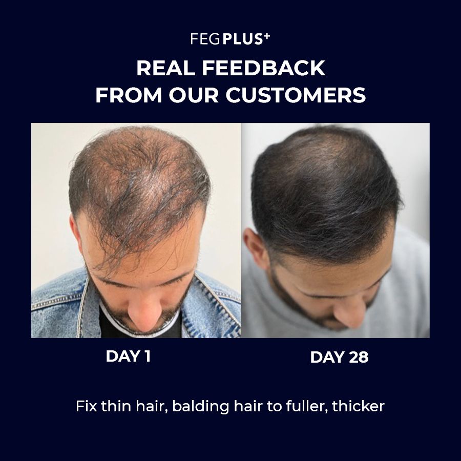 FEG Plus Hair Growth Serum with Hair Roller ( Original)