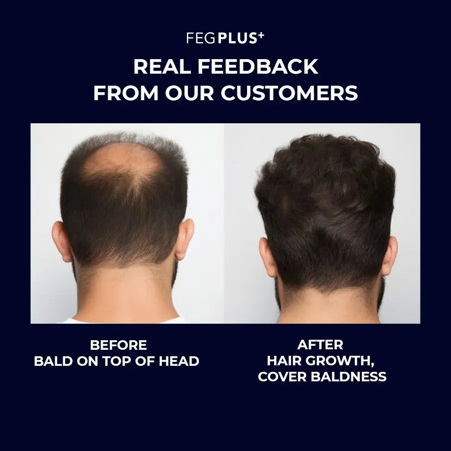 FEG Plus Hair Growth Serum with Hair Roller ( Original) FEGPLUS